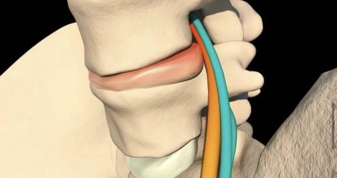 Understanding Different Types of Pain